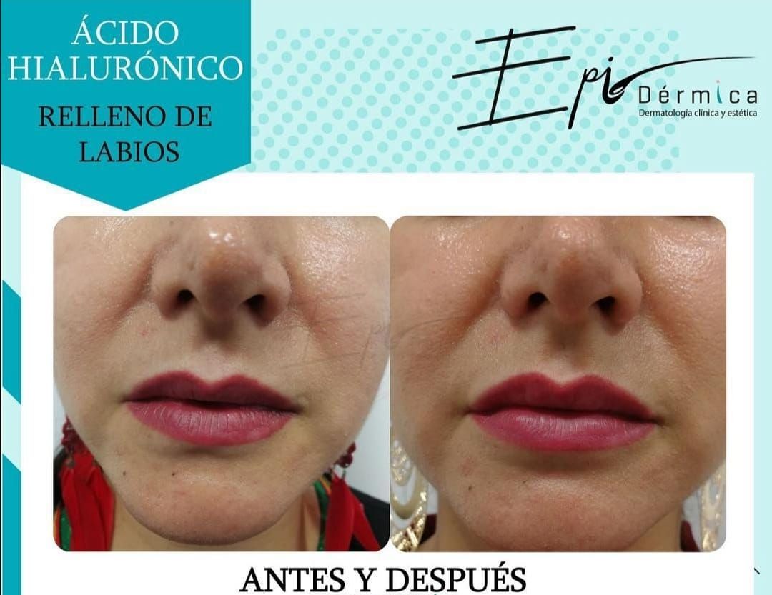 Alejandra Zuluaga-16