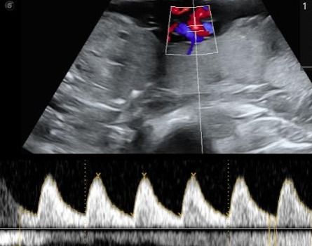 Maite Jesús  Herrera González-2