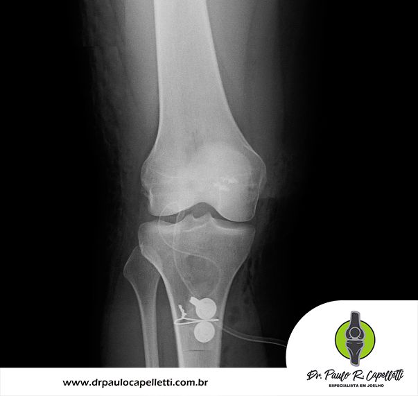 Paulo Roberto Capelletti-50