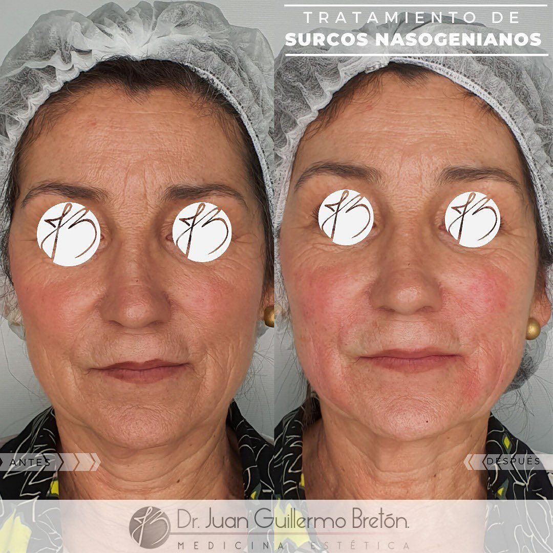 Juan Guillermo Bretón Franco-22