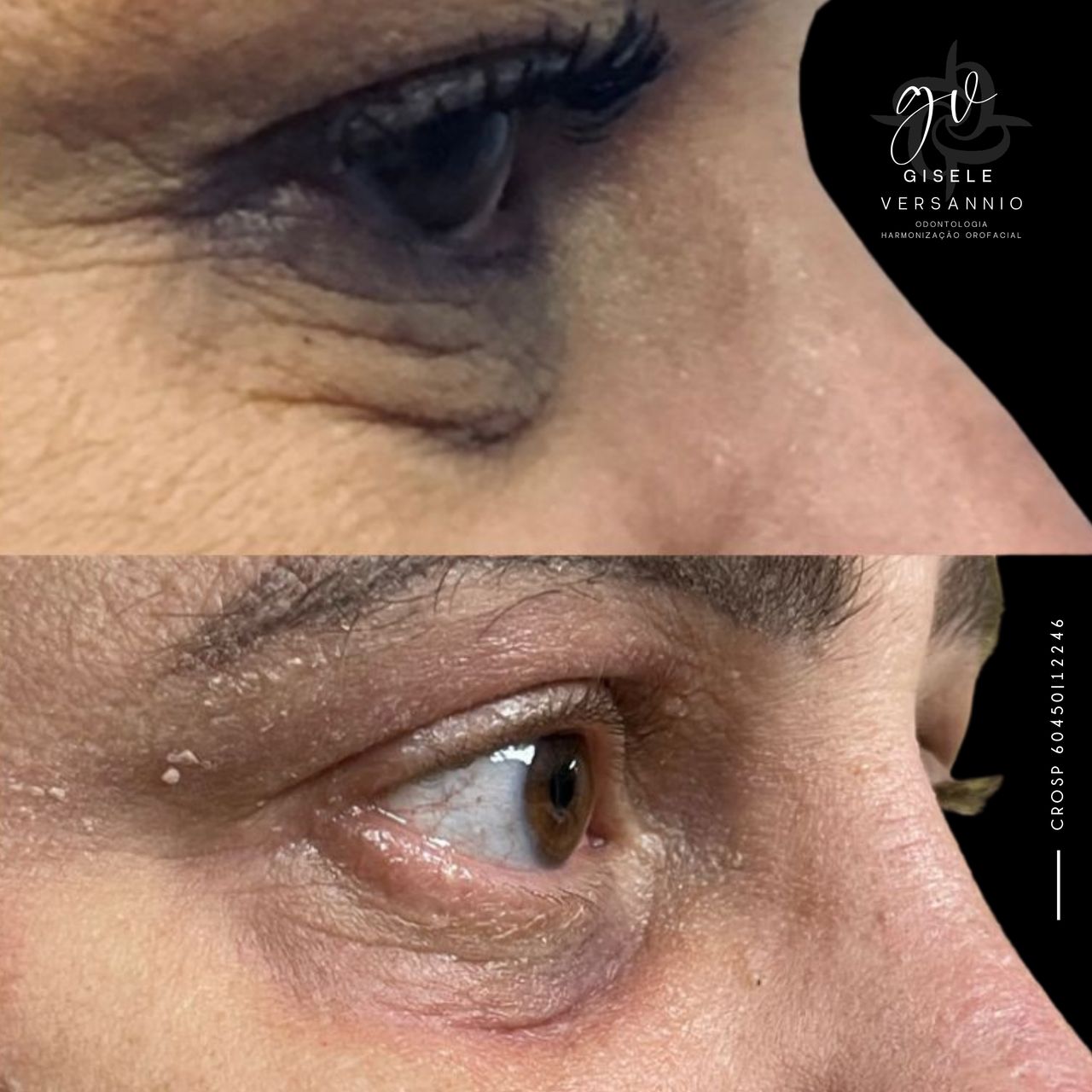 Gisele De Carvalho Versannio-32