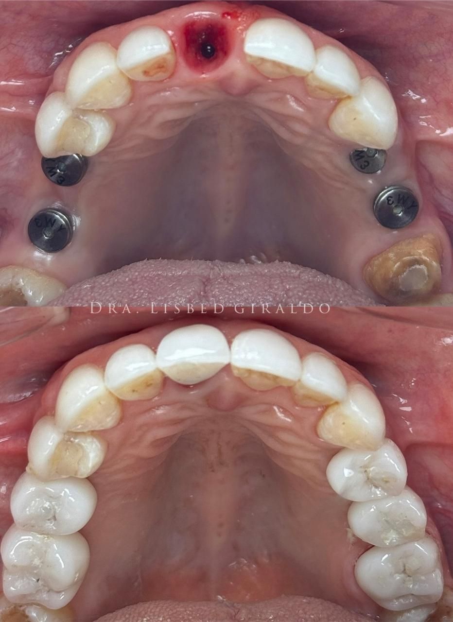 Lisbed Giraldo Olarte-30