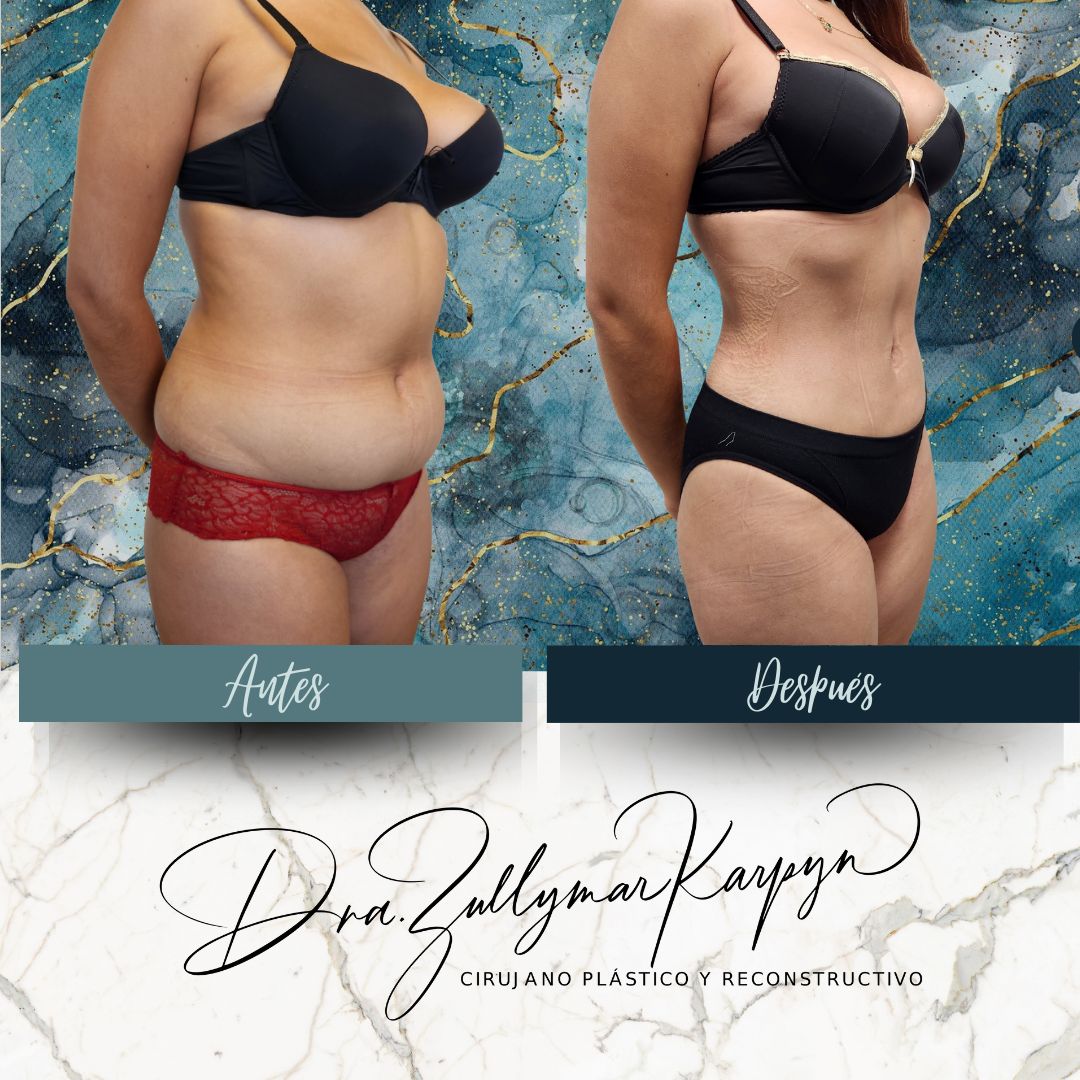 Zullymar Karpyn Brito-11