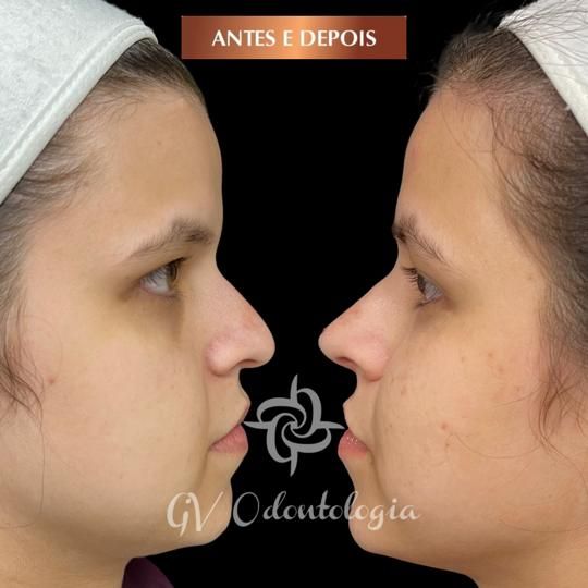 Gisele De Carvalho Versannio-51