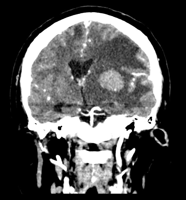 David Tafur Muñoz-1072