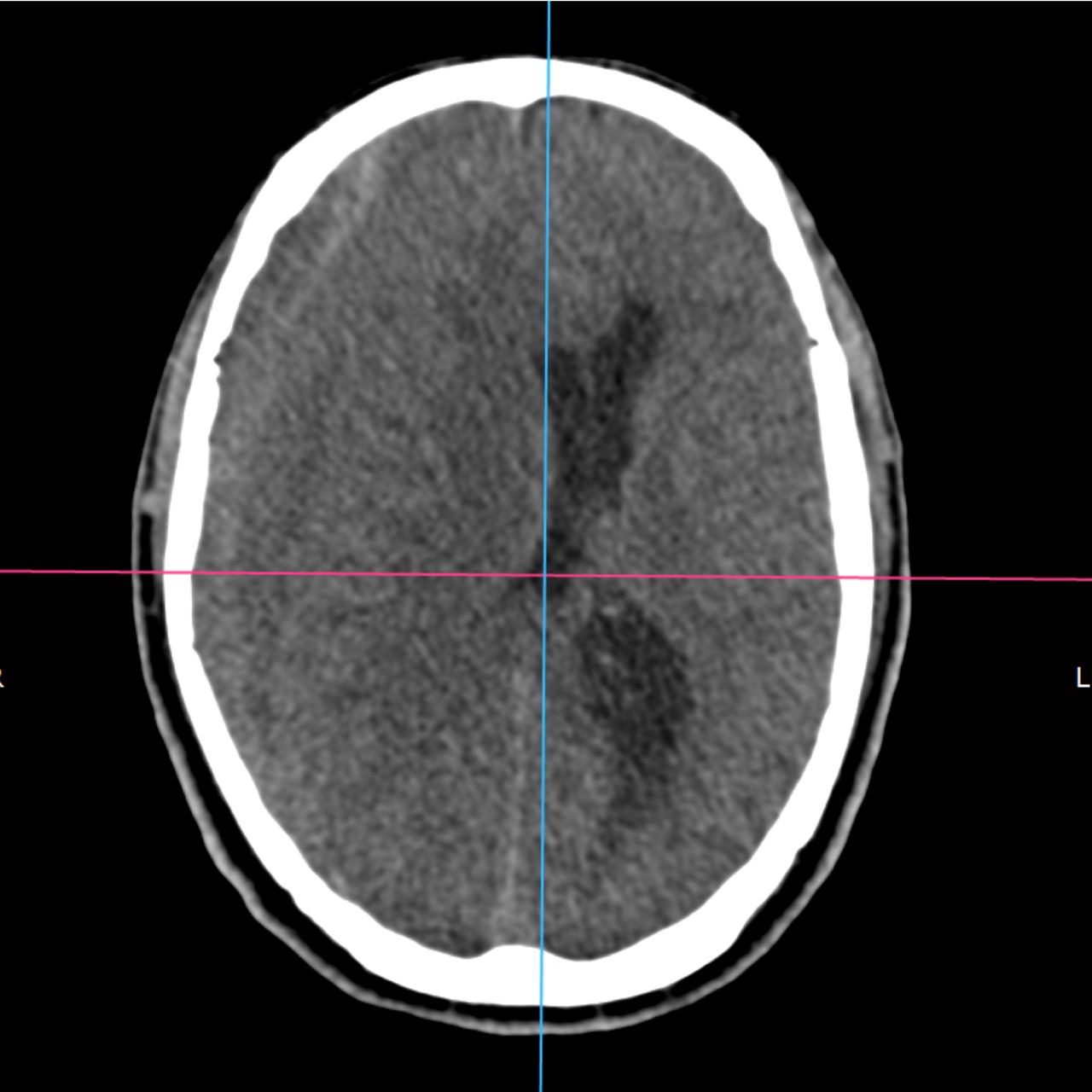 David Tafur Muñoz-2079