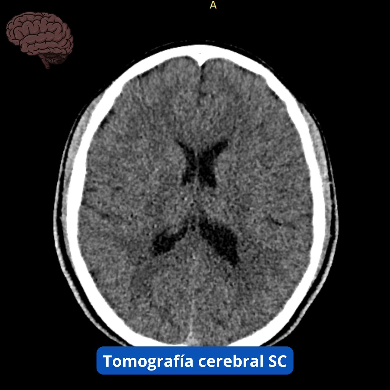 David Tafur Muñoz-1696