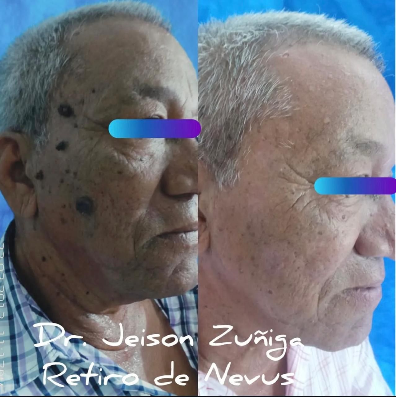 Jeison De Jesus Zuñiga Lara-10