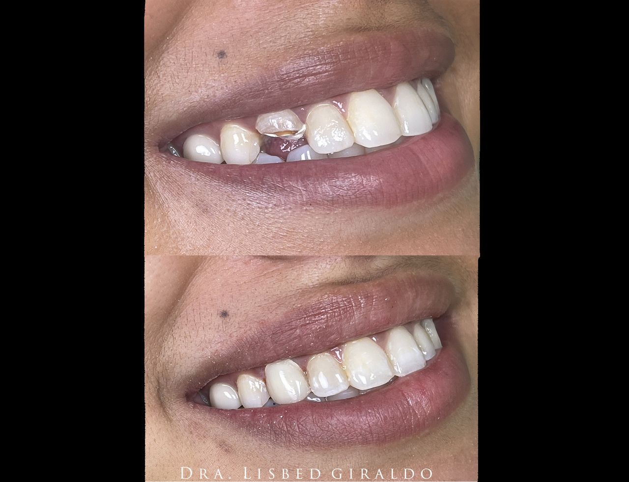 Lisbed Giraldo Olarte-10