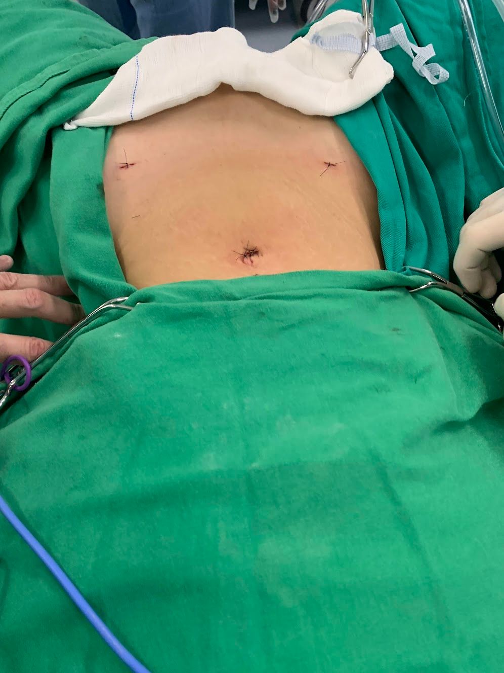 Adalberto Cesario Pereira Junior-39