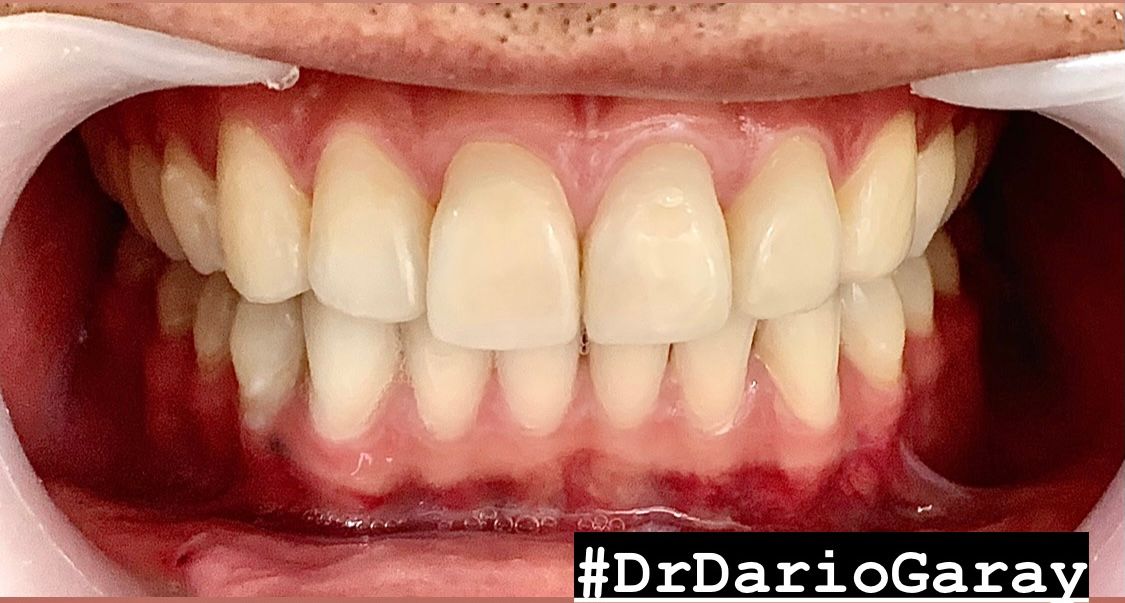 Dario Antonio Garay Chaustre-8