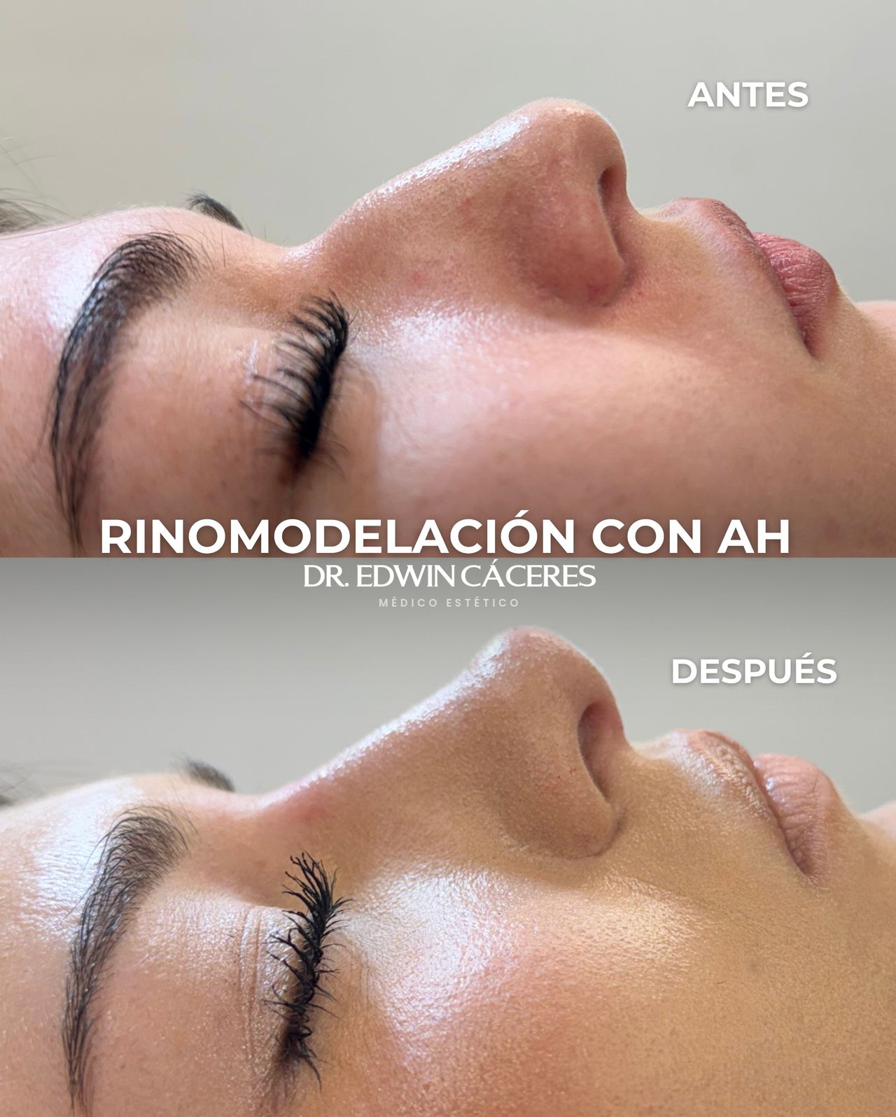 Edwin Cáceres Melendez-2