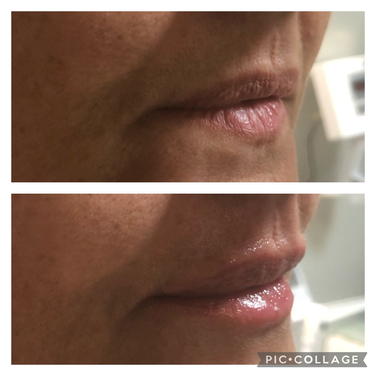 Edilson Martins Rodrigues Neto-6