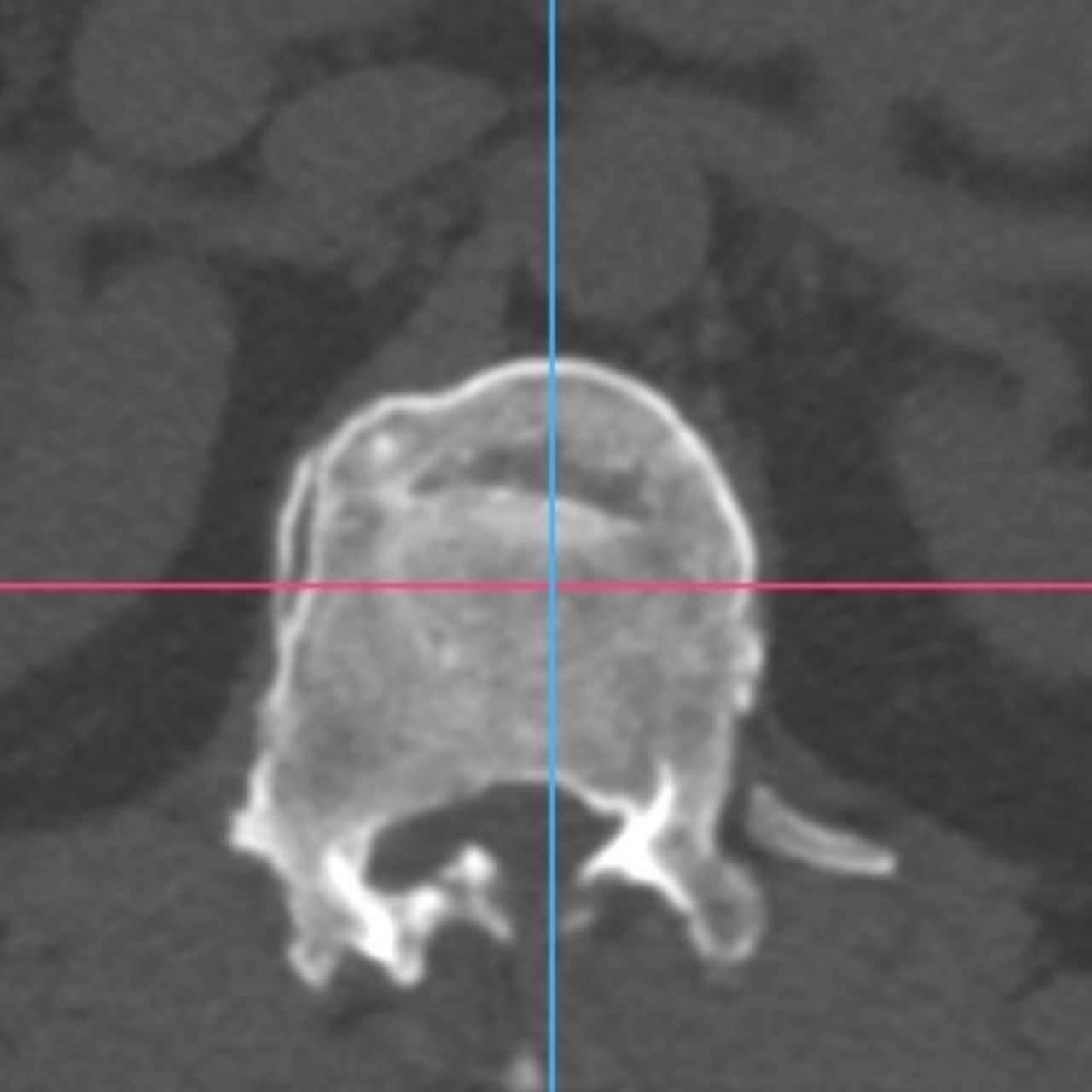 David Tafur Muñoz-2014