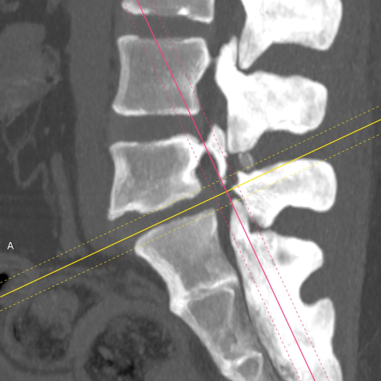 David Tafur Muñoz-2390