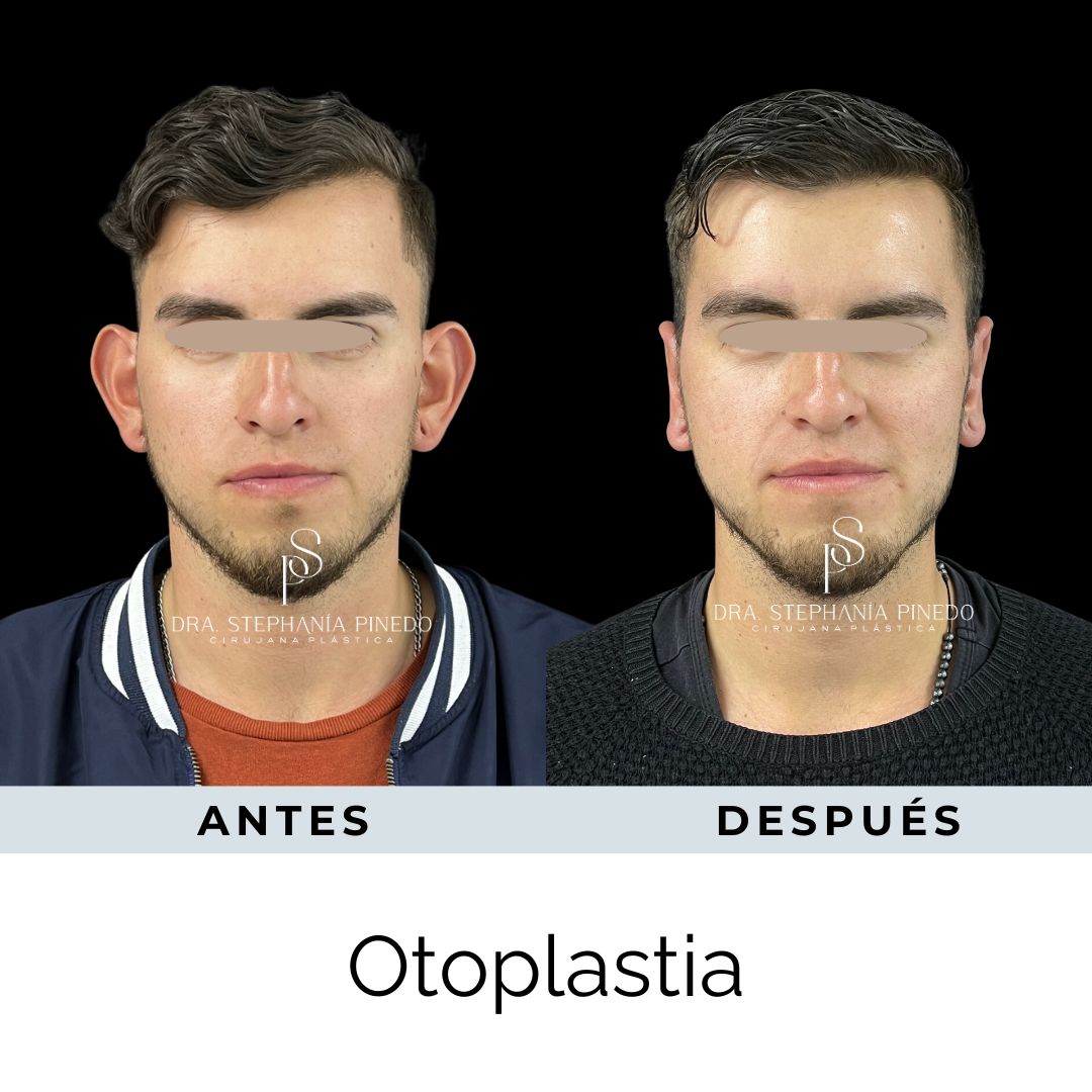 Stephanía Pinedo García-23