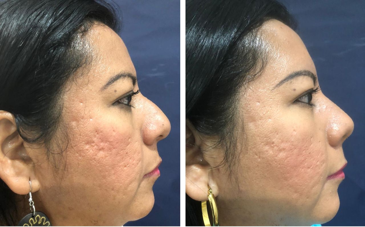 Jorge A Holguin Ruiz-16