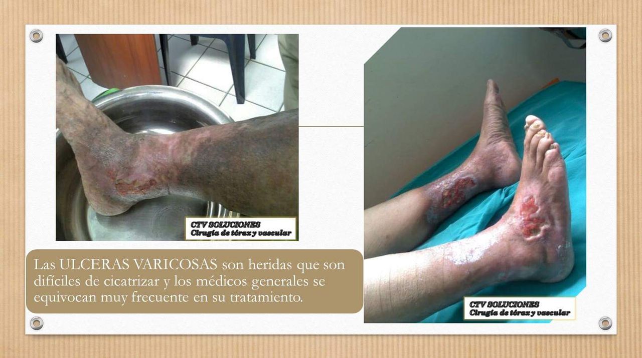 Walter Rodolfo Calle Mendoza-7