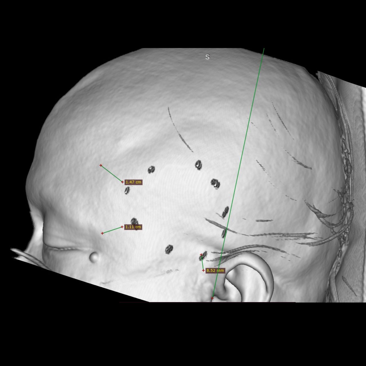 David Tafur Muñoz-1541