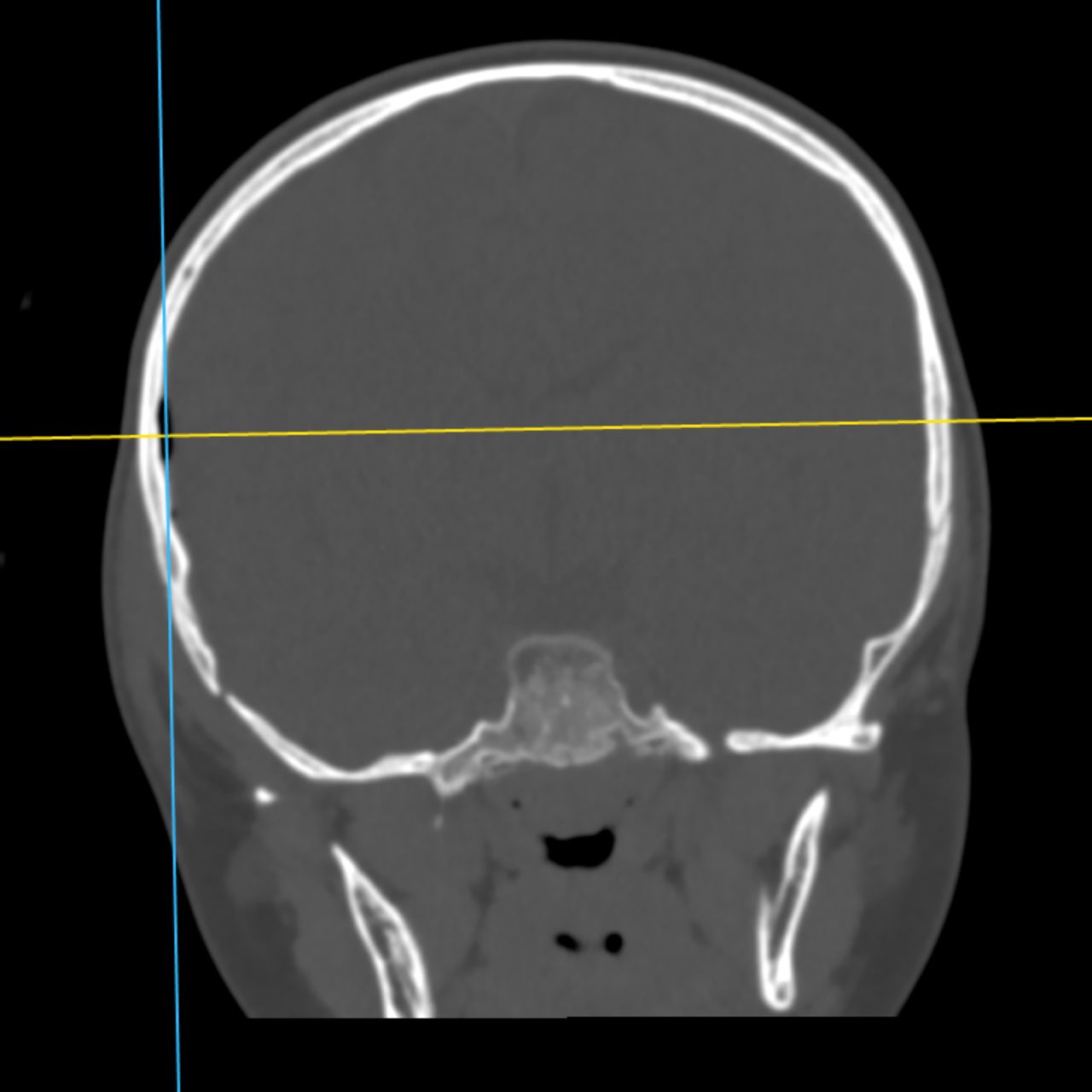 David Tafur Muñoz-2244