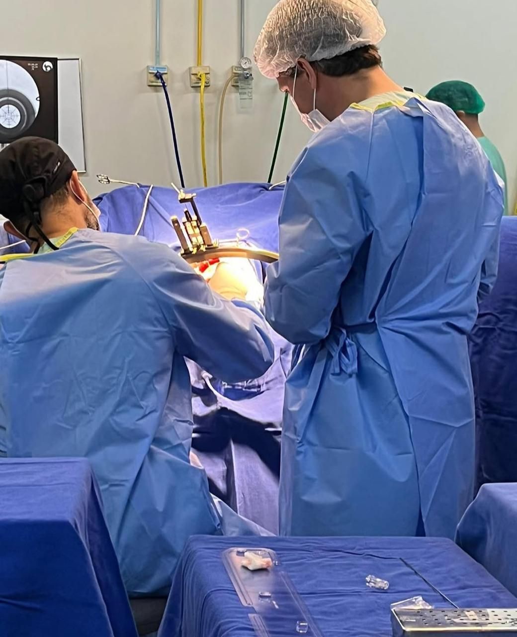 Matheus Schmidt Soares-3