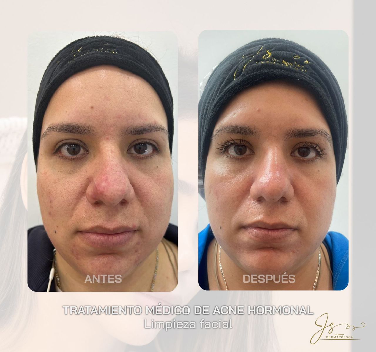 Jasiel Sarai Salas Gomez-10