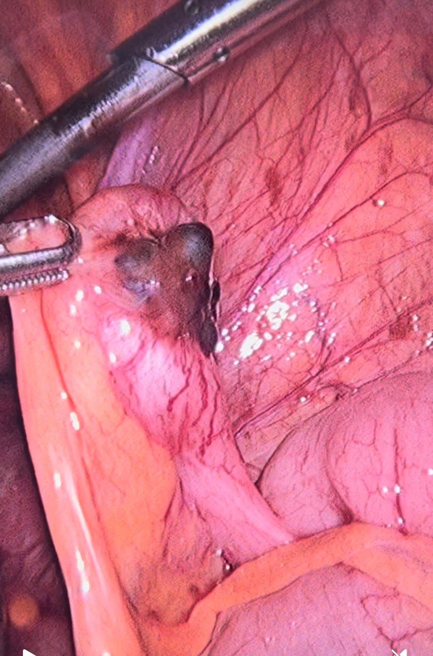 Adalberto Cesario Pereira Junior-36