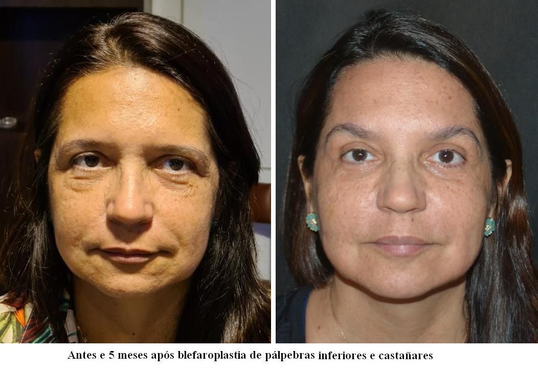 Ingrid  Lustosa Madeira Neves-24