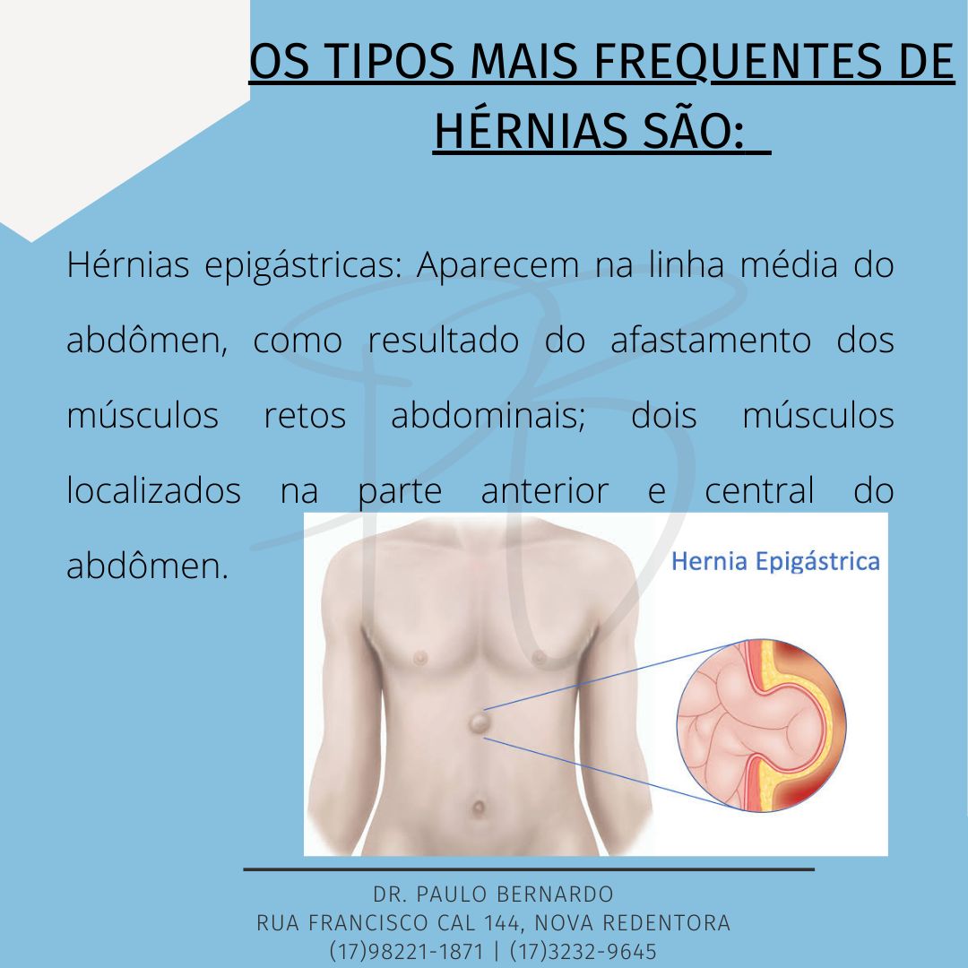 Paulo Leandro Alves Bernardo-8