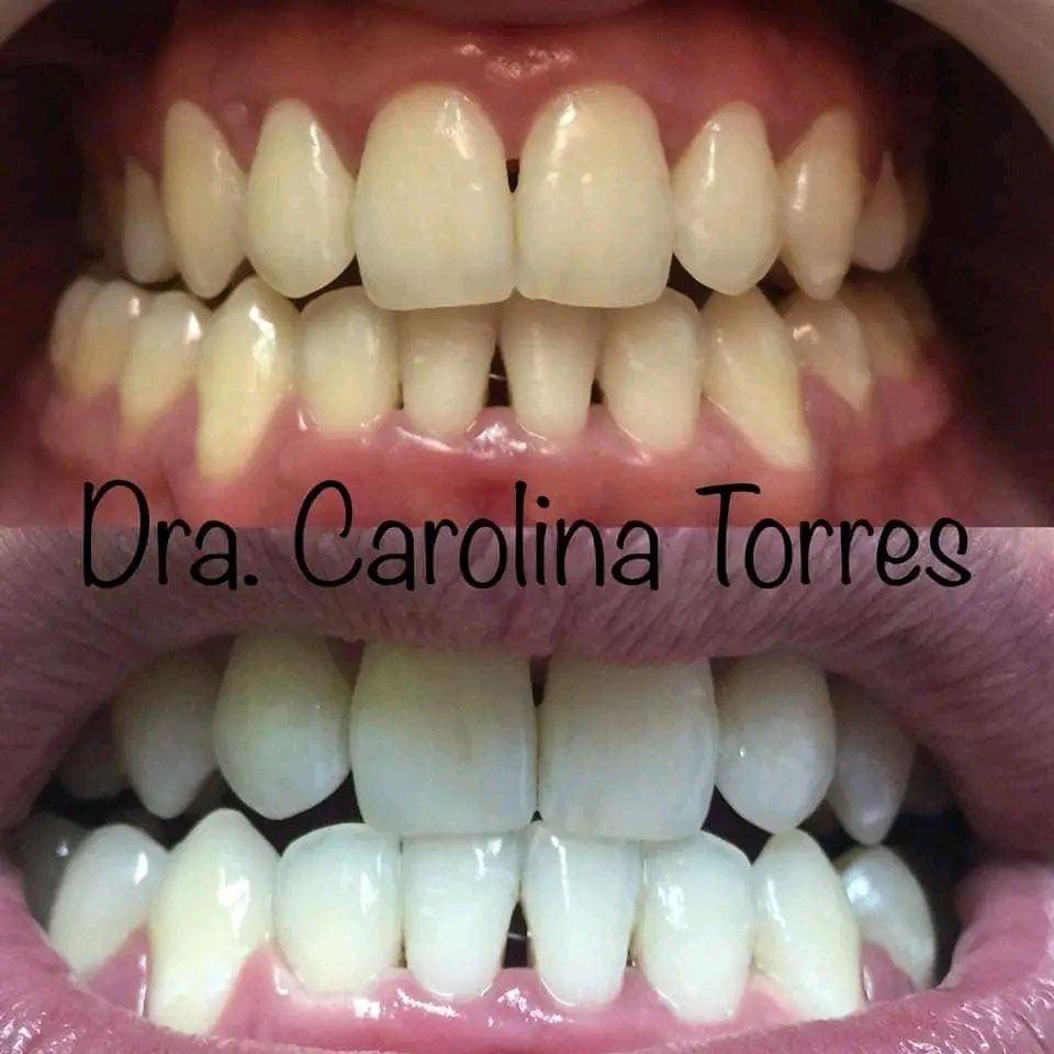 Carolina Alejandra Torres Acuña-5