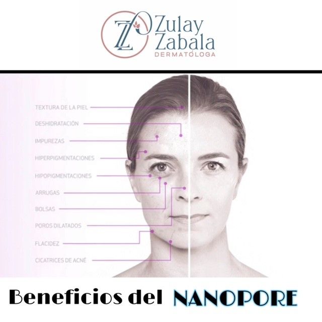 Zulay Angelica Zabala Suarez-60