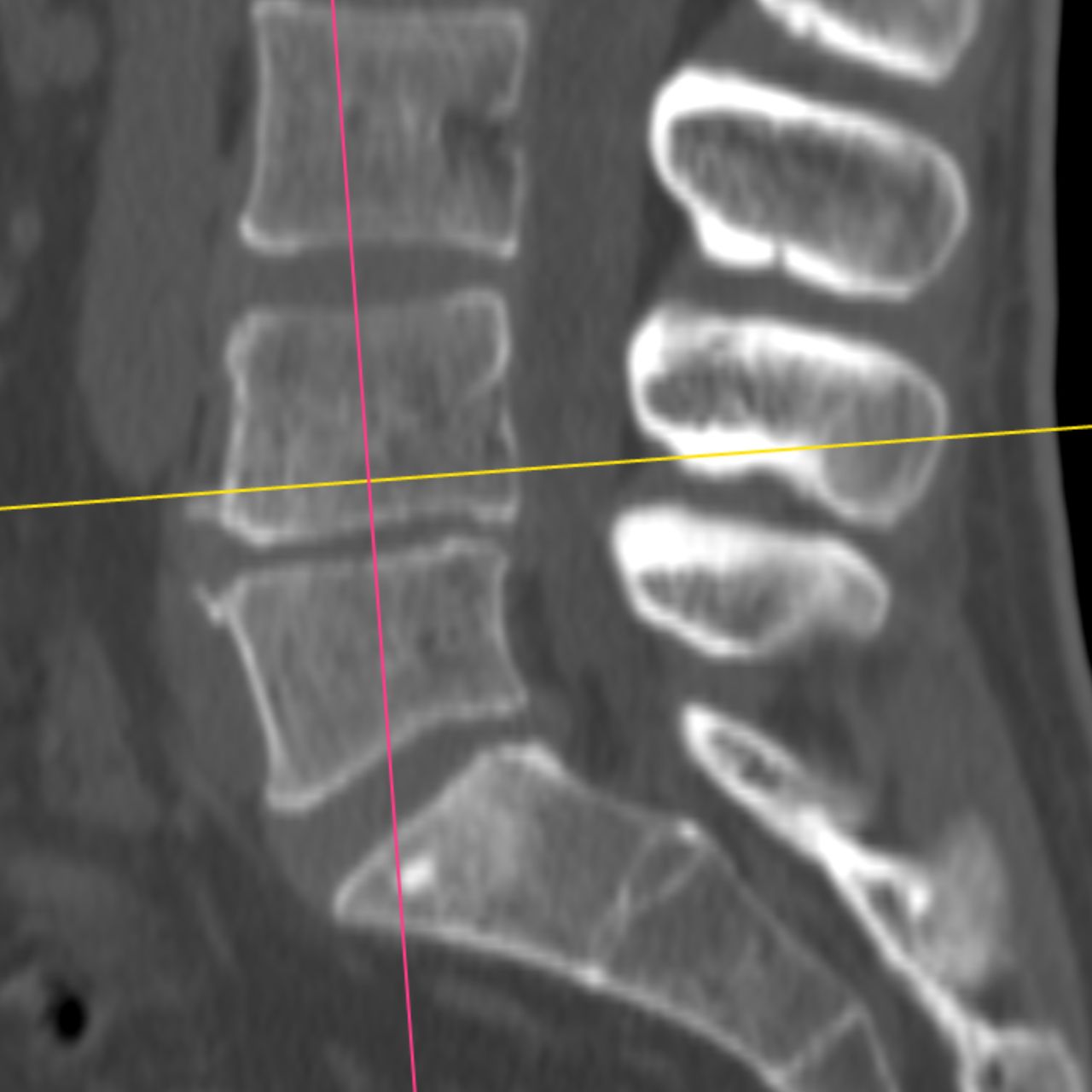 David Tafur Muñoz-1981