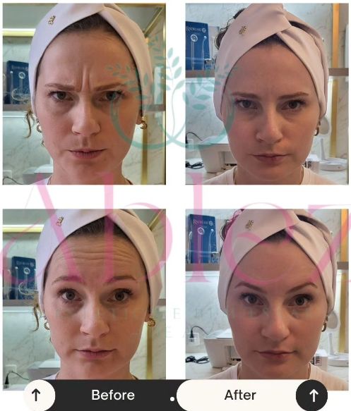 Ana Paula Andreolla-3