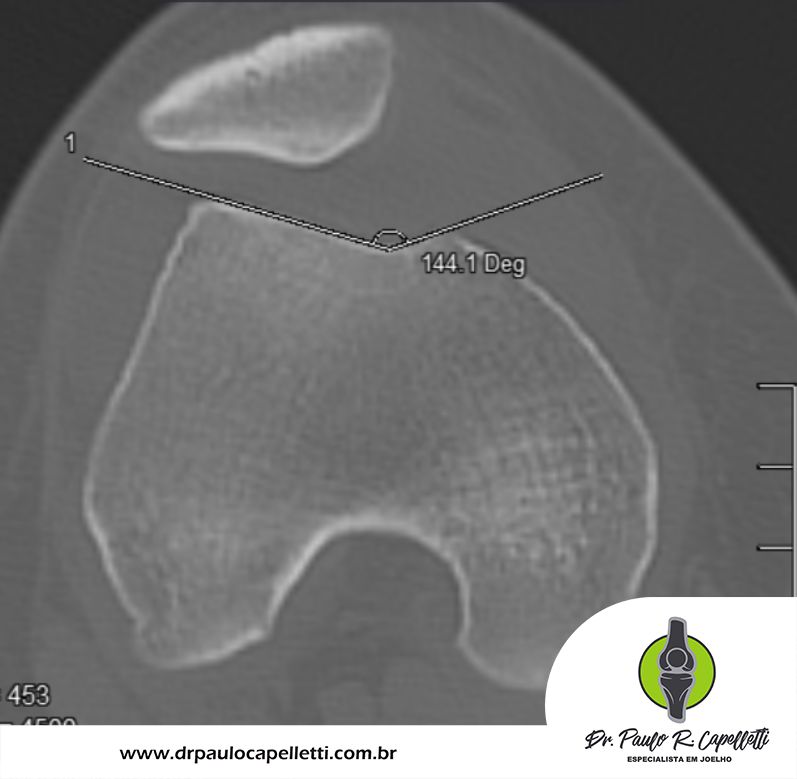 Paulo Roberto Capelletti-49