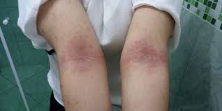 Antonio Carlos Biel-7