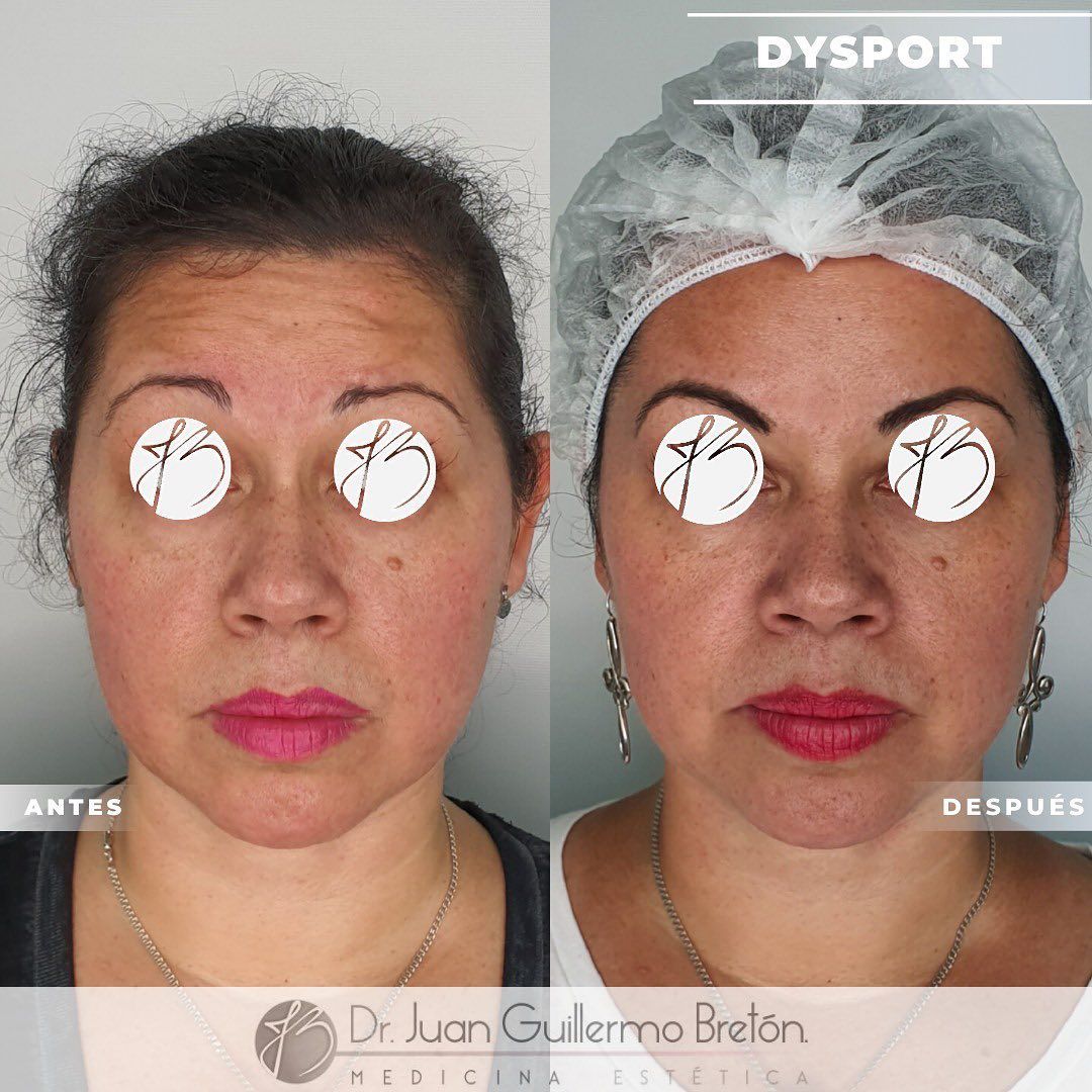 Juan Guillermo Bretón Franco-21