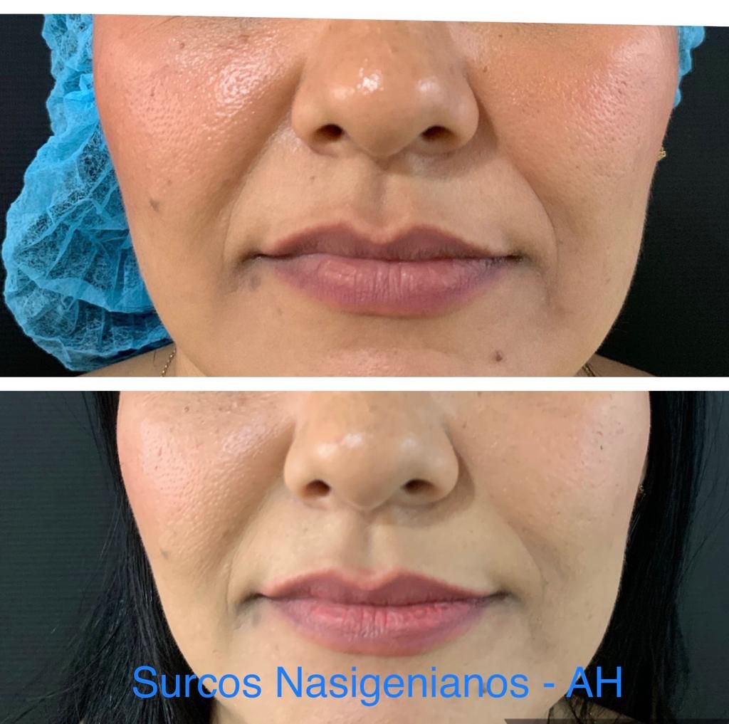 Maria Gisela Angel Losada-63