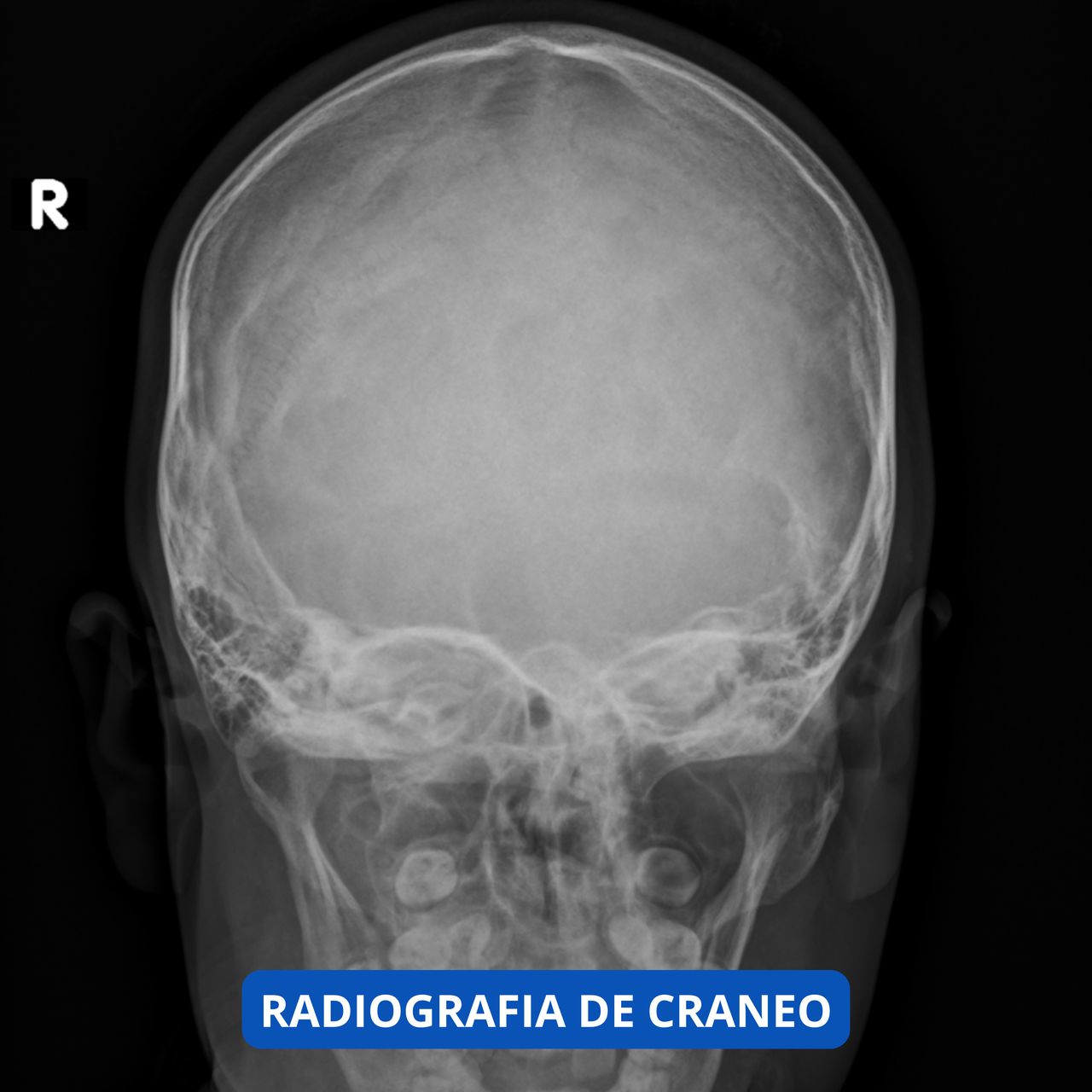 David Tafur Muñoz-1142