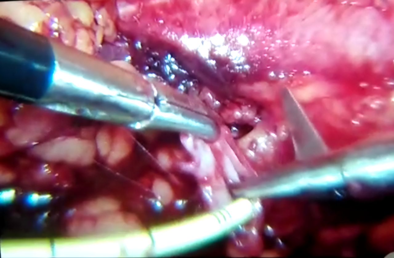 Leonardo Gastón De Oliveira-23