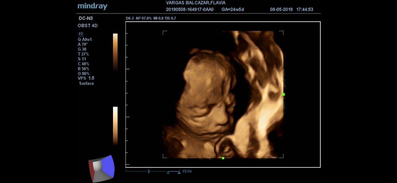 María Denisse Alvarez Huanca-6