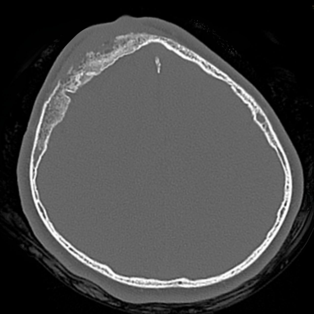 David Tafur Muñoz-1572