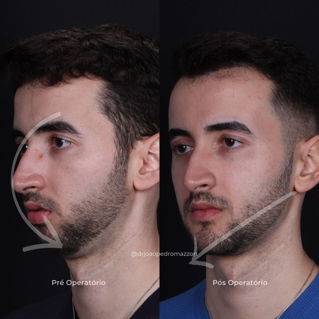 João Pedro Paulino Mazzon-74