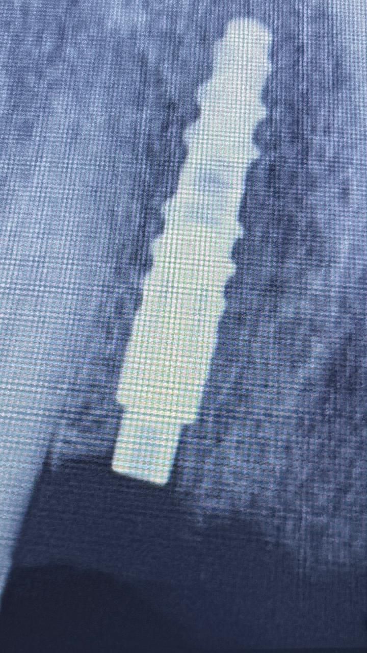 Joel Anderson Valverde Rebaza-8