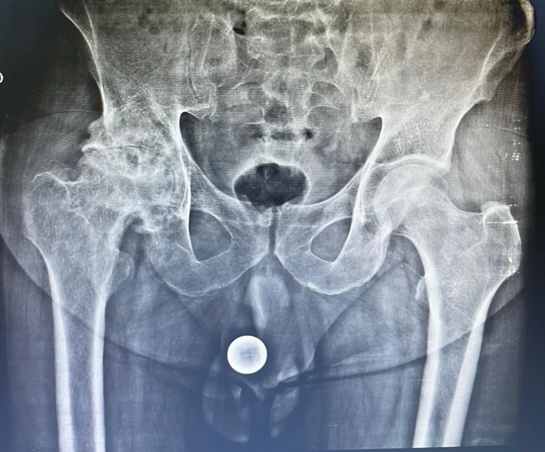 Jônatas Laurindo Giacomini-26