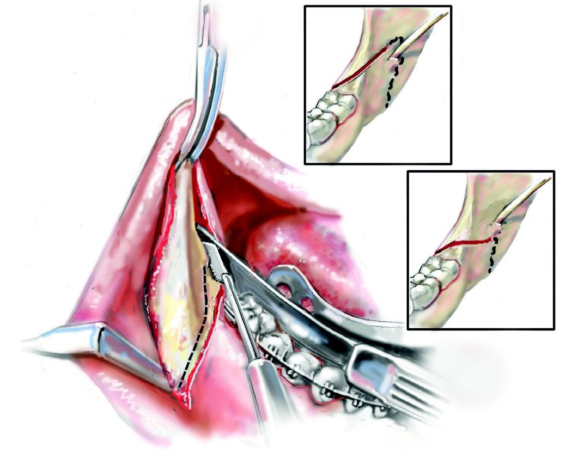 Denis Pimenta E Souza-25