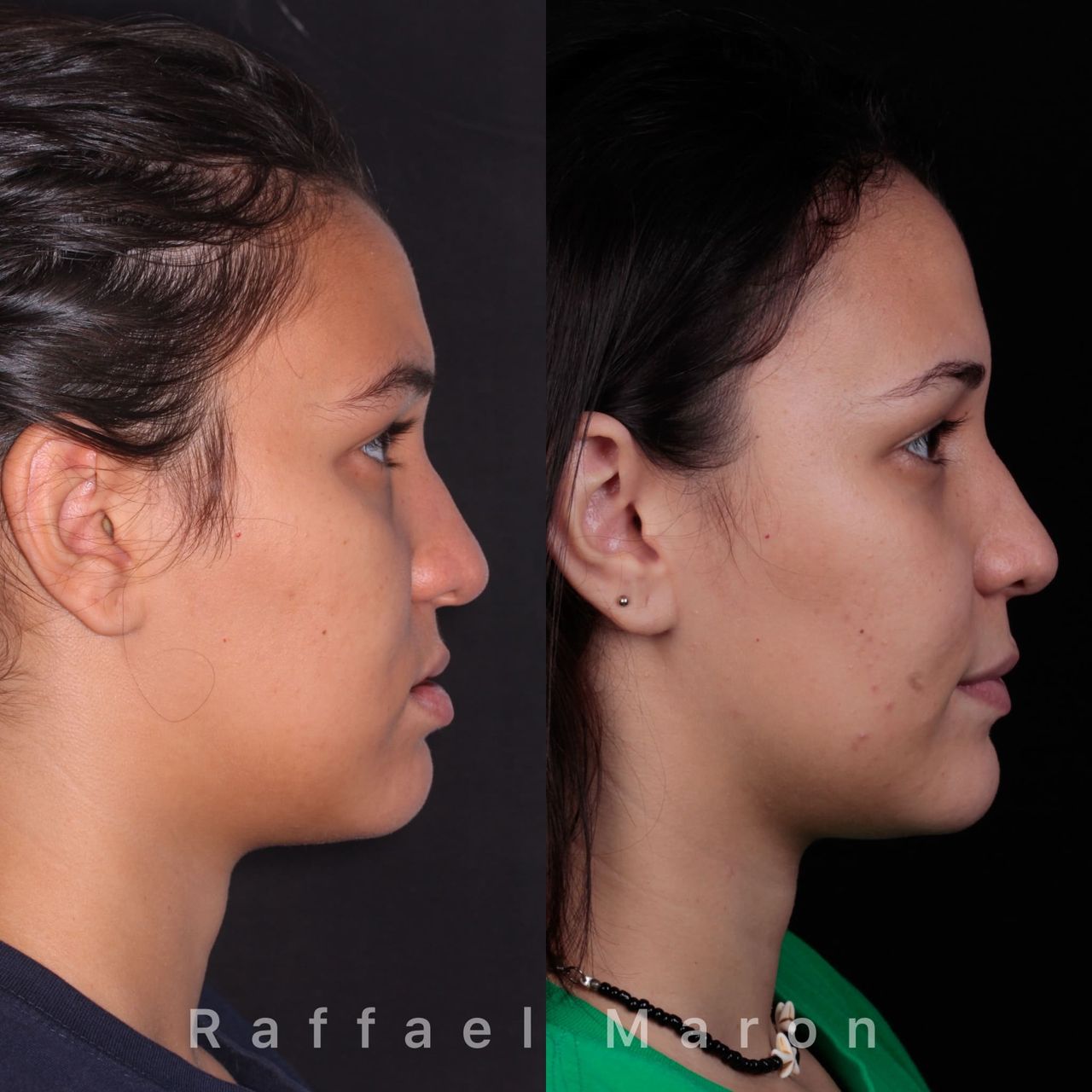 Raffael Maron Vieira De Noronha-20