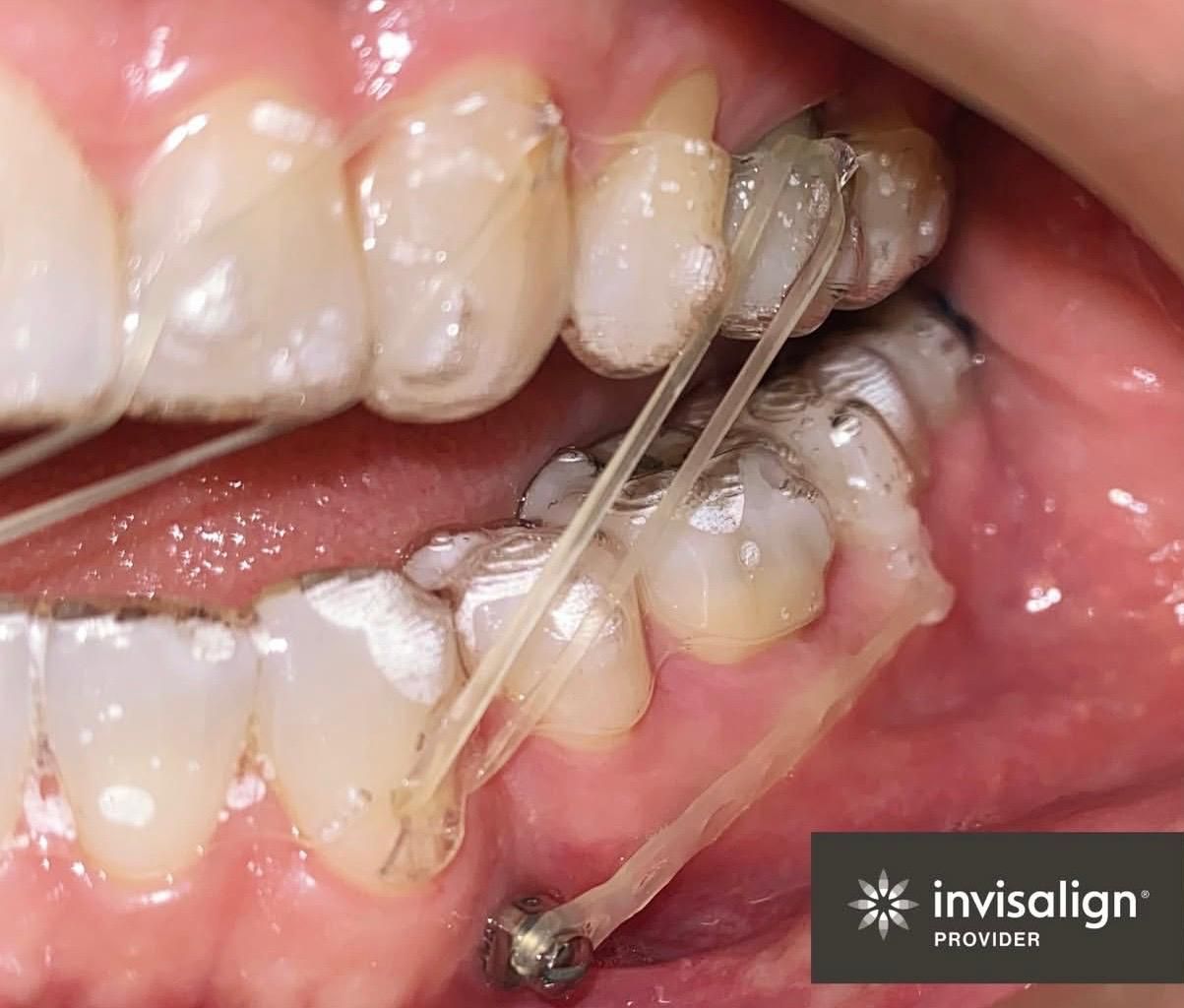 Laura Victoria López Trujillo-9