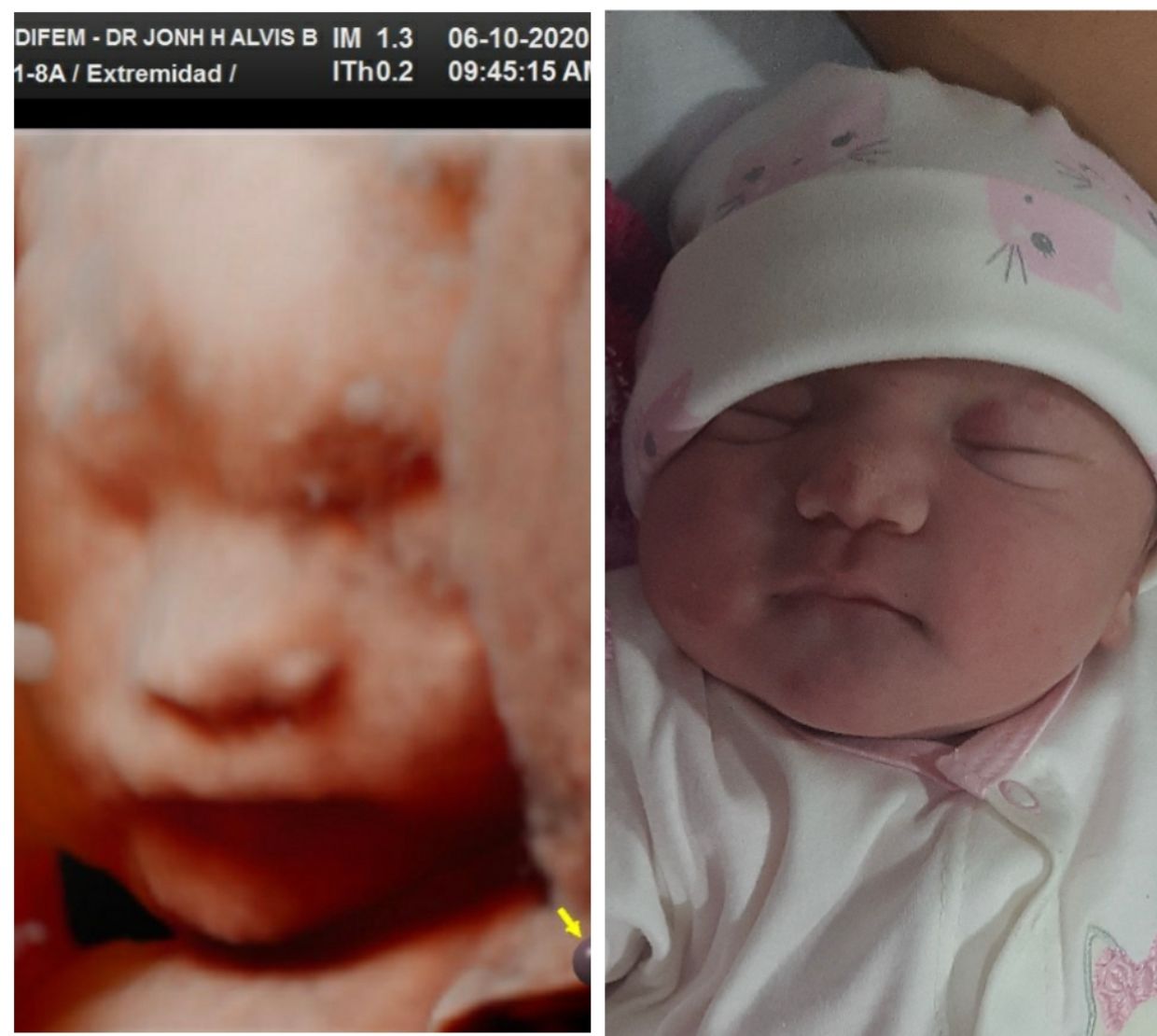 Jonh Harold Alvis Botello-8