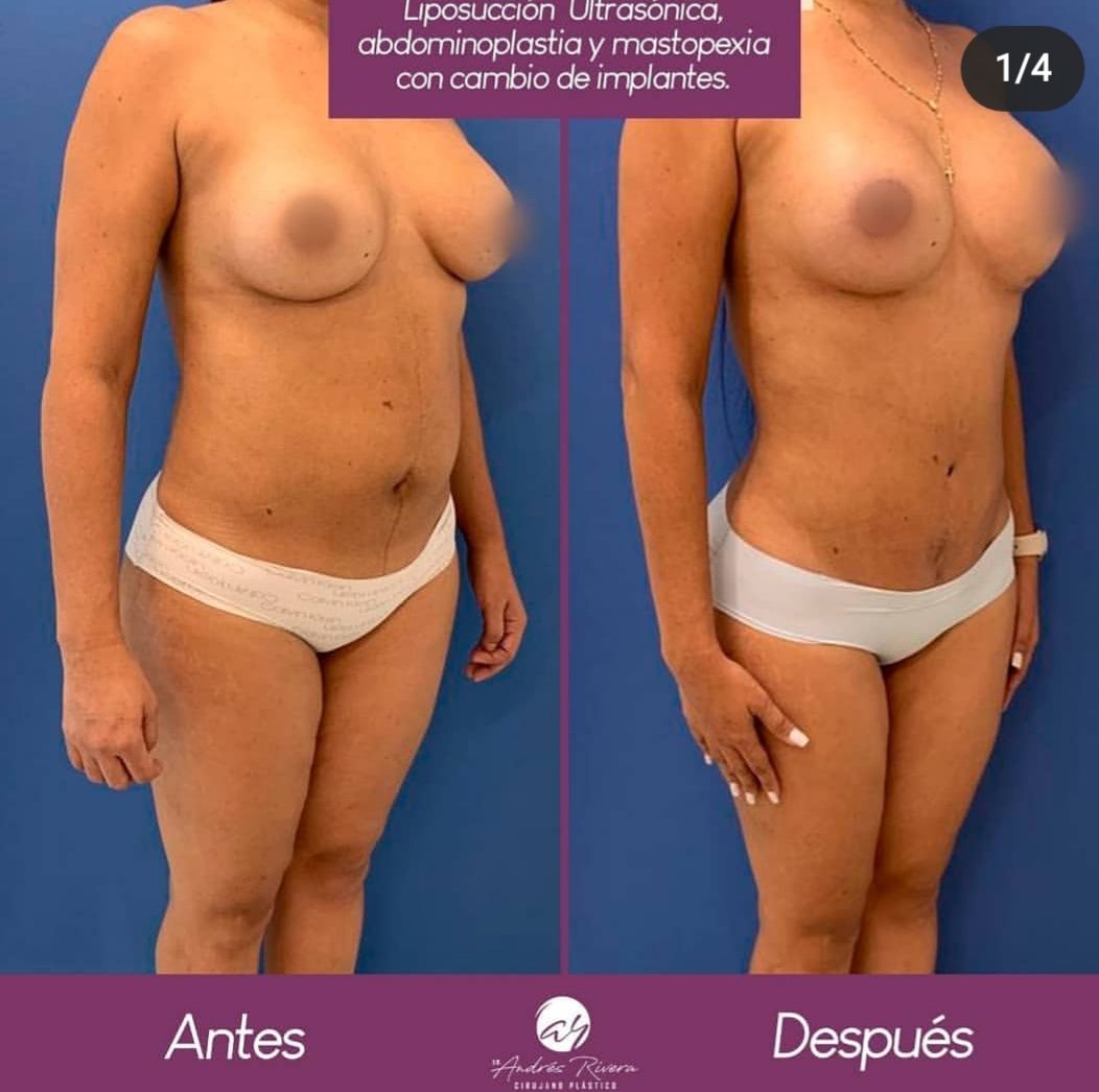 Andrés Rivera López-8