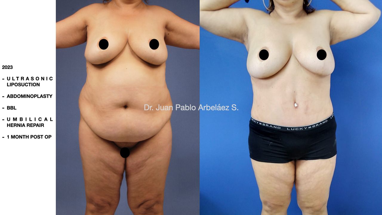 Juan Pablo Arbeláez Sierra-42